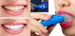 سفید کننده دندان