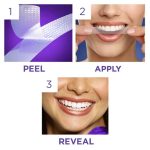 چسب سفید کننده دندان