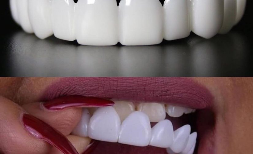 لمینت متحرک ترو اسمایل