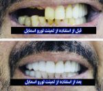 لمینت متحرک ترو اسمایل