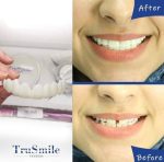 لمینت متحرک ترو اسمایل