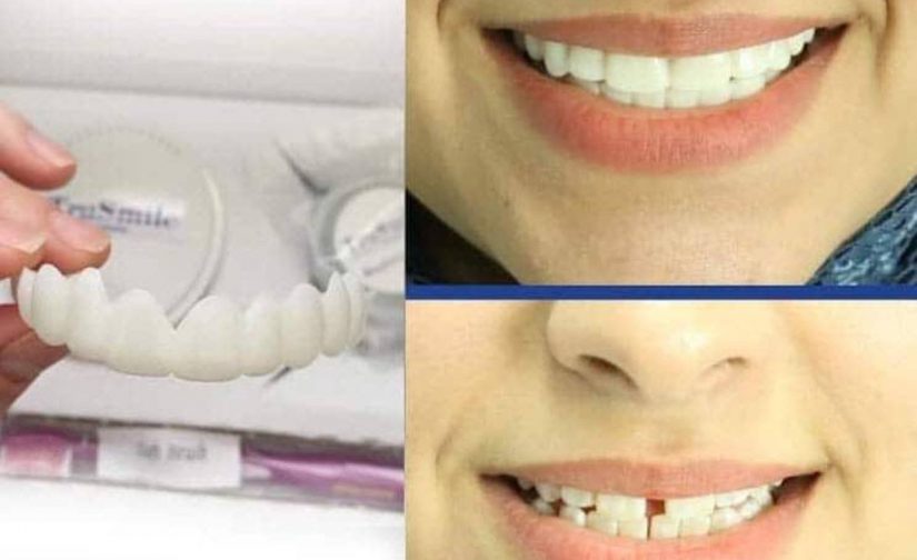 لمینت متحرک ترو اسمایل