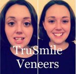 لمینت متحرک ترو اسمایل