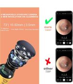 آندوسکوپ و گوش پاک کن کودک و بزرگسال برند شیائومی