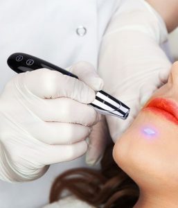 لیزر Picosecond حذف تتو و خال پوستی قابل حمل